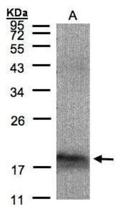 Invitrogen ARMET Polyclonal Antibody 100 &mu;L; Unconjugated:Antibodies,