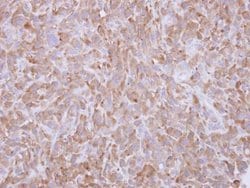 Invitrogen Profilin 1 Polyclonal Antibody 100 &mu;L; Unconjugated:Antibodies,