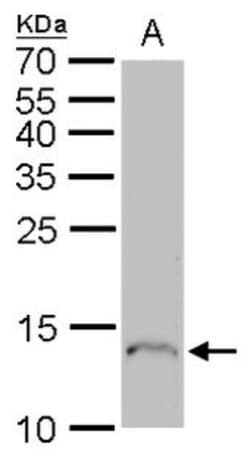Invitrogen Profilin 1 Polyclonal Antibody 100 &mu;L; Unconjugated:Antibodies,