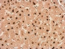 Invitrogen TALDO1 Polyclonal Antibody 100 &mu;L; Unconjugated:Antibodies,