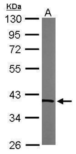 Invitrogen TALDO1 Polyclonal Antibody 100 &mu;L; Unconjugated:Antibodies,