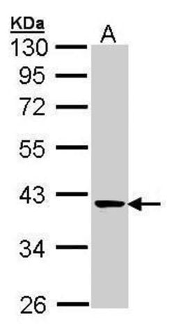 Invitrogen TALDO1 Polyclonal Antibody 100 &mu;L; Unconjugated:Antibodies,