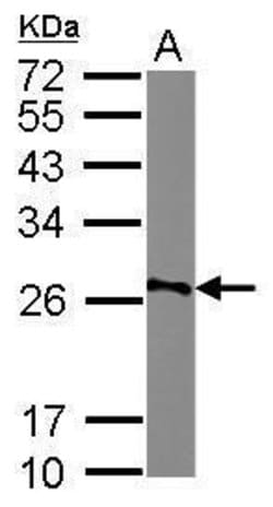 Invitrogen AGPAT1 Polyclonal Antibody 100 &mu;L | Buy Online | Invitrogen&trade; | Fisher Scientific
