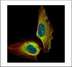 Invitrogen NFkB p65 Polyclonal Antibody 100 &mu;L; Unconjugated:Antibodies,