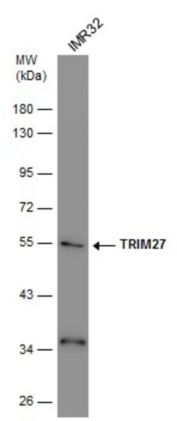Invitrogen TRIM27 Polyclonal Antibody 100 &mu;L; Unconjugated:Antibodies,
