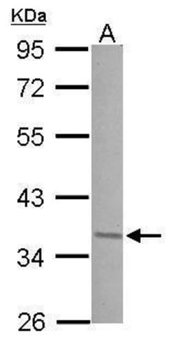 Invitrogen JunD Polyclonal Antibody 100 &mu;L; Unconjugated:Antibodies,