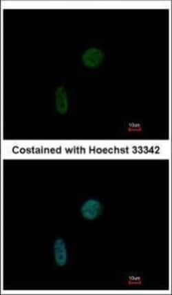 Invitrogen CIZ1 Polyclonal Antibody 100 &mu;L | Buy Online | Invitrogen&trade; | Fisher Scientific