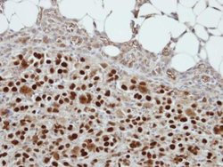 Invitrogen CIZ1 Polyclonal Antibody 100 &mu;L | Buy Online | Invitrogen&trade; | Fisher Scientific