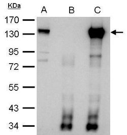 Invitrogen CIZ1 Polyclonal Antibody 100 &mu;L | Buy Online | Invitrogen&trade; | Fisher Scientific