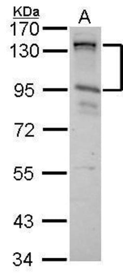 Invitrogen CIZ1 Polyclonal Antibody 100 &mu;L | Buy Online | Invitrogen&trade; | Fisher Scientific