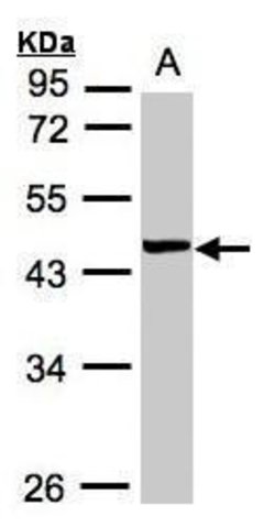 Invitrogen VPS72 Polyclonal Antibody 100 &mu;L; Unconjugated:Antibodies,