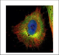 Invitrogen Cofilin Polyclonal Antibody 100 μL; Unconjugated:Antibodies,
