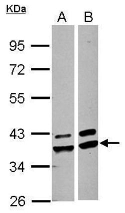 Invitrogen AKR1A1 Polyclonal Antibody 100 μL; Unconjugated:Antibodies,