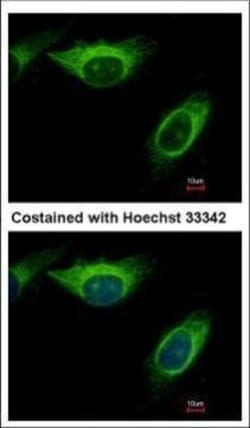Invitrogen MEK2 Polyclonal Antibody 100 &mu;L; Unconjugated:Antibodies,
