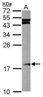 SUMO2 Polyclonal Antibody, Invitrogen 100 μL; Unconjugated