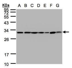 Invitrogen 14-3-3 theta Polyclonal Antibody 100 &mu;L; Unconjugated:Antibodies,