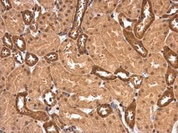 Invitrogen PPP2R1A Polyclonal Antibody 100 &mu;L; Unconjugated:Antibodies,