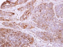 Invitrogen Talin 1 Polyclonal Antibody 100 &mu;L; Unconjugated:Antibodies,