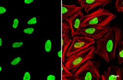 Invitrogen TRIM28 Polyclonal Antibody 100 &mu;L; Unconjugated:Antibodies,