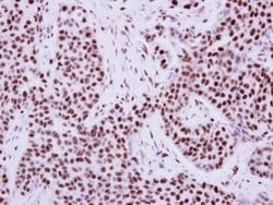 Invitrogen TRIM28 Polyclonal Antibody 100 &mu;L; Unconjugated:Antibodies,