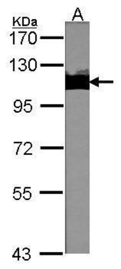 Invitrogen TRIM28 Polyclonal Antibody 100 &mu;L; Unconjugated:Antibodies,
