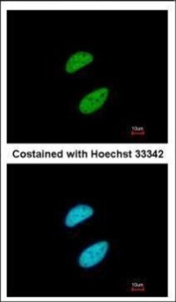 Invitrogen TRIM28 Polyclonal Antibody 100 &mu;L; Unconjugated:Antibodies,
