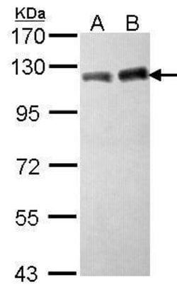 Invitrogen TRIM28 Polyclonal Antibody 100 &mu;L; Unconjugated:Antibodies,