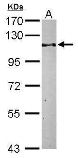 Invitrogen TRIM28 Polyclonal Antibody 100 &mu;L; Unconjugated:Antibodies,