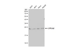 Invitrogen LYPLA2 Polyclonal Antibody 100 &mu;L; Unconjugated:Antibodies,