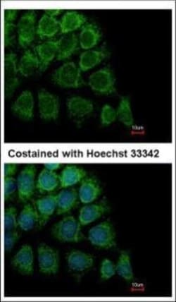 Invitrogen HYOU1 Polyclonal Antibody 100 &mu;L | Buy Online | Invitrogen&trade; | Fisher Scientific