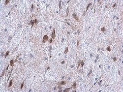 Invitrogen HYOU1 Polyclonal Antibody 100 &mu;L | Buy Online | Invitrogen&trade; | Fisher Scientific