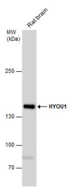 Invitrogen HYOU1 Polyclonal Antibody 100 &mu;L | Buy Online | Invitrogen&trade; | Fisher Scientific