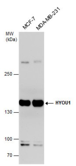 Invitrogen HYOU1 Polyclonal Antibody 100 &mu;L | Buy Online | Invitrogen&trade; | Fisher Scientific