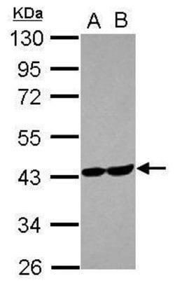 Invitrogen Aldolase C Polyclonal Antibody 100 &mu;L | Buy Online | Invitrogen&trade; | Fisher Scientific