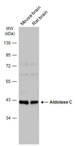 Invitrogen Aldolase C Polyclonal Antibody 100 &mu;L | Buy Online | Invitrogen&trade; | Fisher Scientific