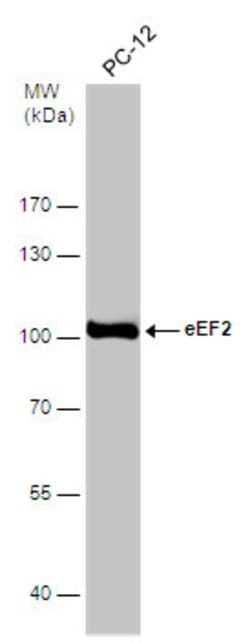 Invitrogen EEF2 Polyclonal Antibody 100 &mu;L; Unconjugated:Antibodies,