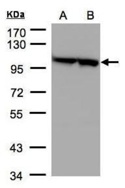 Invitrogen EEF2 Polyclonal Antibody 100 &mu;L; Unconjugated:Antibodies,