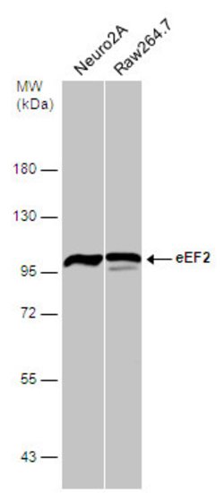Invitrogen EEF2 Polyclonal Antibody 100 &mu;L; Unconjugated:Antibodies,