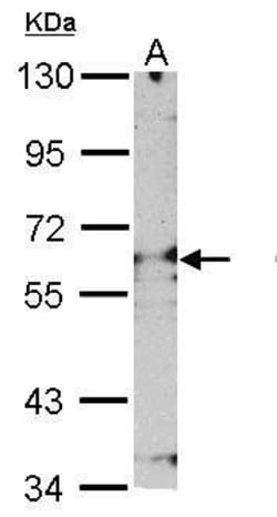 Invitrogen PSMD3 Polyclonal Antibody 100 &mu;L | Buy Online | Invitrogen&trade; | Fisher Scientific