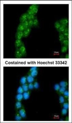 Invitrogen PSMD3 Polyclonal Antibody 100 &mu;L; Unconjugated:Antibodies,