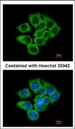 Invitrogen EEF1D Polyclonal Antibody 100 &mu;L; Unconjugated:Antibodies,