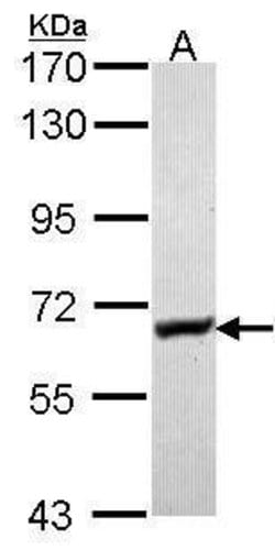 Invitrogen Glycerol kinase Polyclonal Antibody 100 &mu;L; Unconjugated:Antibodies,