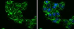 Invitrogen Glycerol kinase Polyclonal Antibody 100 &mu;L; Unconjugated:Antibodies,