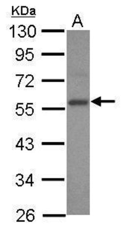 Invitrogen E2F3 Polyclonal Antibody 100 &mu;L | Buy Online | Invitrogen&trade; | Fisher Scientific