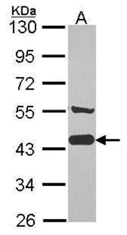 Invitrogen AHA1 Polyclonal Antibody 100 &mu;L | Buy Online | Invitrogen&trade; | Fisher Scientific