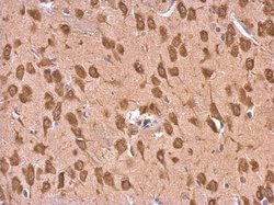 Invitrogen EEF1A2 Polyclonal Antibody 100 &mu;L; Unconjugated:Antibodies,