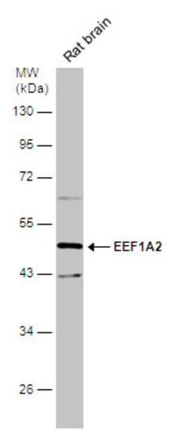 Invitrogen EEF1A2 Polyclonal Antibody 100 &mu;L; Unconjugated:Antibodies,