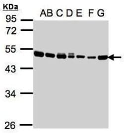 Invitrogen EEF1A2 Polyclonal Antibody 100 &mu;L; Unconjugated:Antibodies,