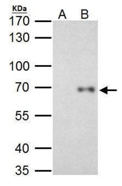 Invitrogen RelB Polyclonal Antibody 100 &mu;L; Unconjugated:Antibodies,