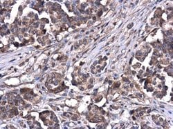 Invitrogen ATG5 Polyclonal Antibody 100 &mu;L; Unconjugated:Antibodies,